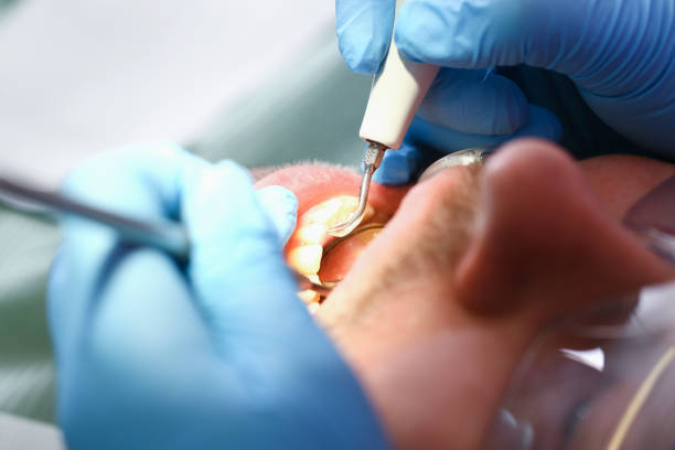 Best Emergency Gum Pain Relief  in Keys, OK