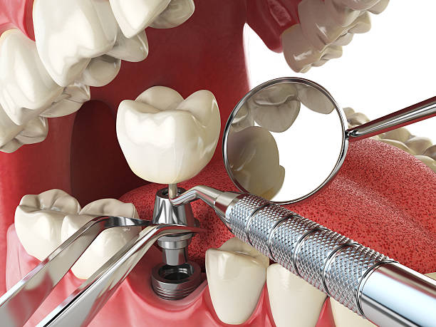 Best Urgent Tooth Repair  in Keys, OK
